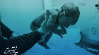 الولادة القيصرية