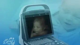 فحص السونار الرباعي