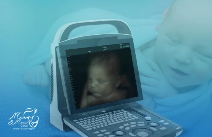 فحص السونار الرباعي