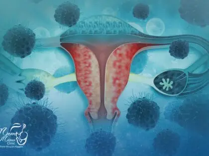 عملية استئصال الورم الليفي