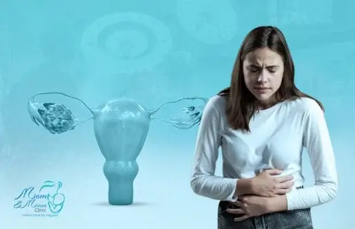 تعرفي إلى أنواع تكيس المبايض وطرق علاجها الممكنة