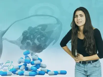 علاج تكيسات المبايض